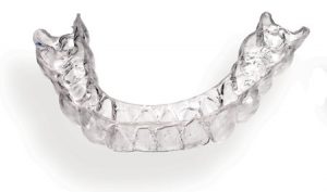invisible braces for adults